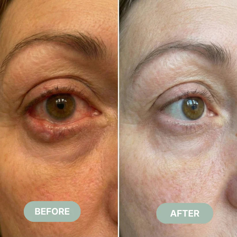 MistMuse™ - Eye Steam PRO