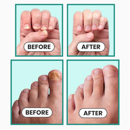 Podo Lume Dual-Light Therapy