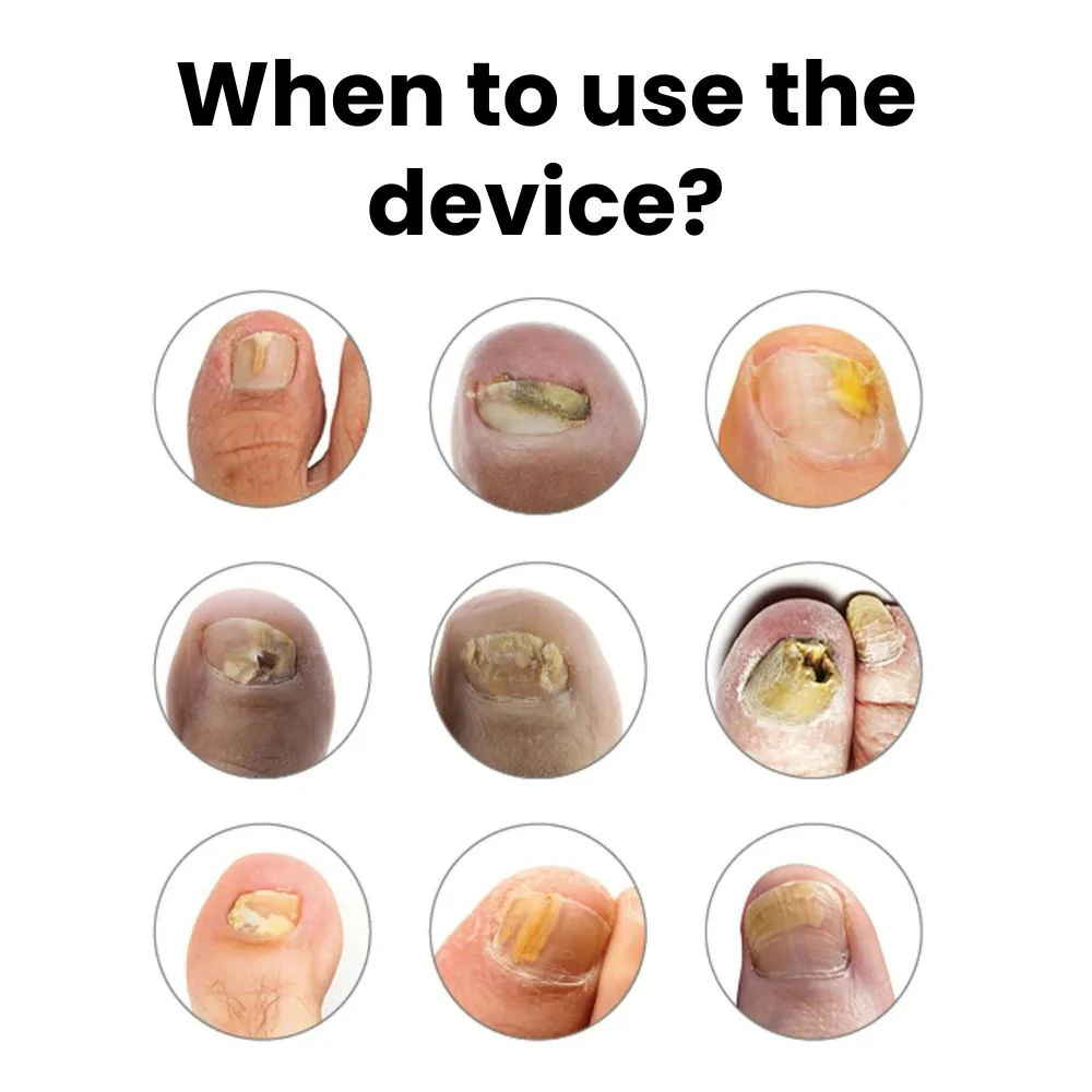 Podo Lume Dual-Light Therapy